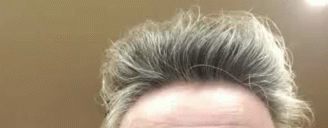 Forehead Bored GIF - Forehead Bored Nothing To Do GIFs