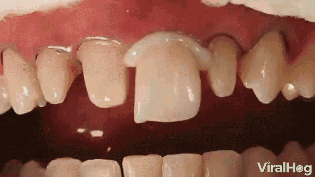Teeth Dentures GIF - Teeth Dentures Glue GIFs