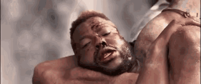 a man with blood on his face is laying on a bed .