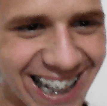 a close up of a man 's face with braces on his teeth