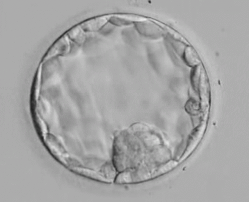 Expanded Blastocyst GIF