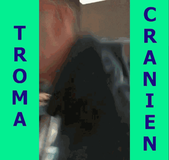 Troma Cranien GIF - Troma Cranien Romain GIFs