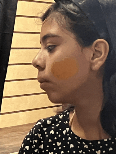 a young girl wearing a black and white polka dot shirt has a yellow spot on her cheek