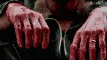 a close up of a person 's bloody hands with a ring on the finger