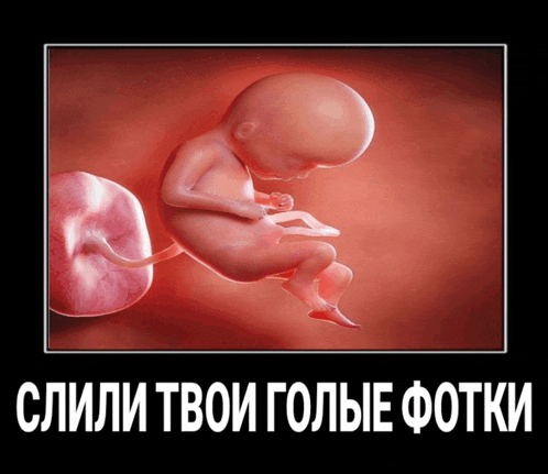 a picture of a baby in the womb with russian text below it