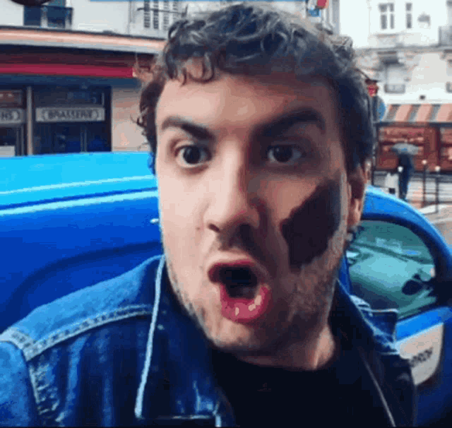 a man with a black spot on his face stands in front of a blue van