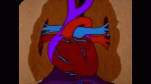 Heart Stroke GIF - Heart Stroke GIFs