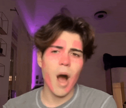 a young man with red spots on his face is singing