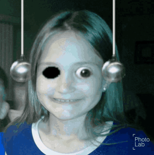 a girl with a black eye and a blue shirt has a photo lab watermark