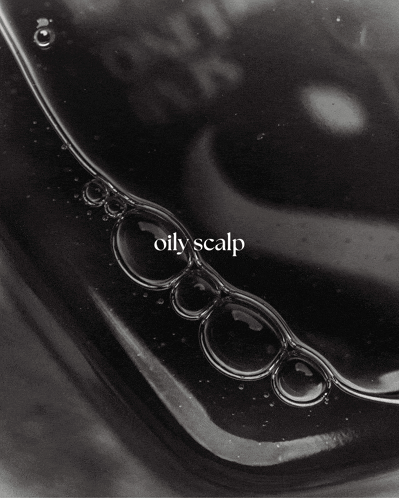 a black and white photo with the words oily scalp on it
