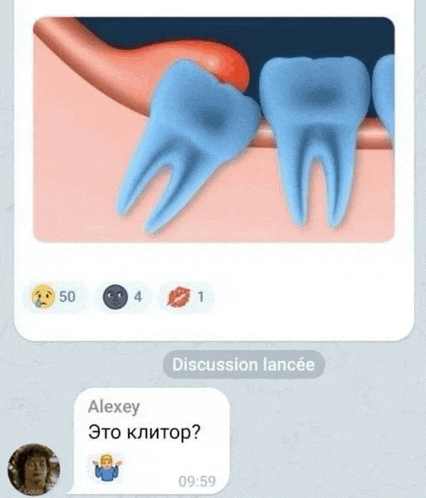 a conversation between alexey and discussion lancee with a picture of teeth