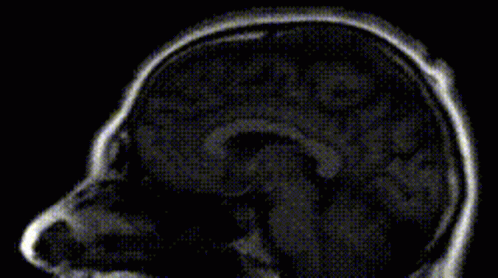 Roccos Brain Brainwasher GIF - Roccos Brain Brainwasher Brain GIFs