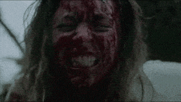 a woman with blood on her face is screaming and crying .