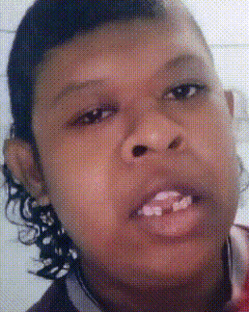 a close up of a person 's face with a tooth missing
