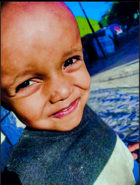 a child with a bald head and a striped sweater smiles for the camera