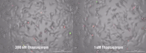Cell Stress GIF - Cell Stress GIFs