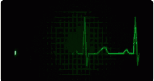 Heart Stopped GIF - Heart Stopped Pulse GIFs