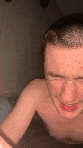 a shirtless man with acne on his face