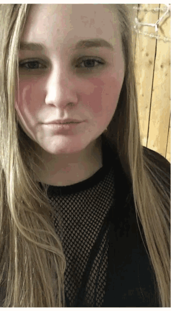 a woman with long blonde hair and a red cheek is wearing a black shirt