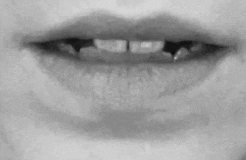 a black and white photo of a person 's mouth with a broken tooth .