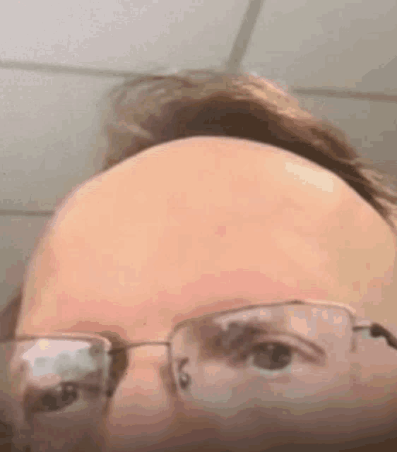 a close up of a man 's head with glasses and a bald head .
