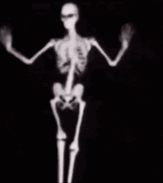 Dancing Skeleton Dancing Skeleton Gif GIF