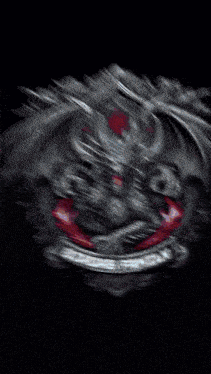 a white light shines through a dark background