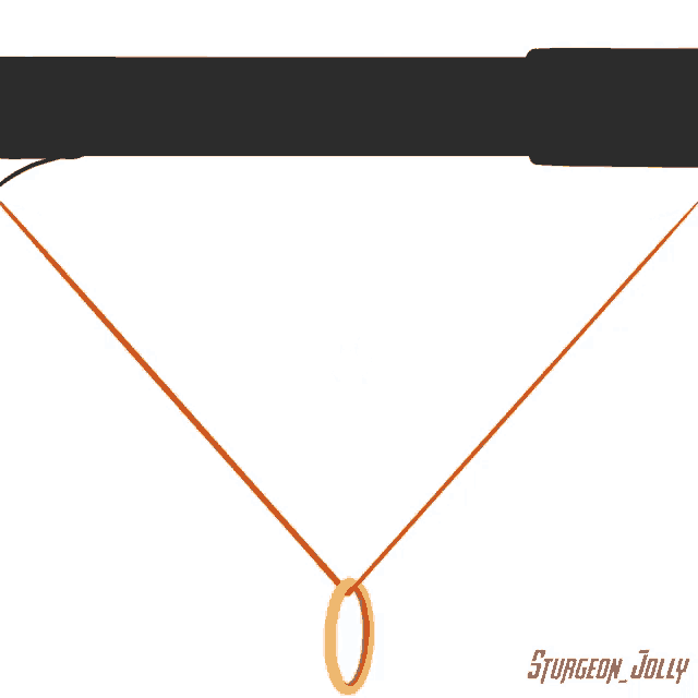 a drawing of a gold ring on a red string with surgeon jolly written below it