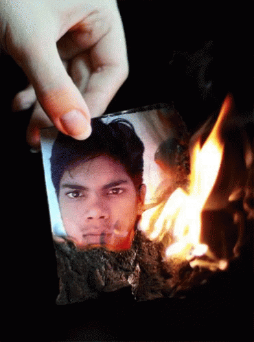 Santosh Dawar Burn GIF - Santosh Dawar Burn Picture Burn GIFs