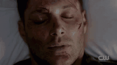 a man with black eyes is laying in a bed with blood on his face .