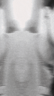 a black and white photo of a person 's face with a striped shirt .