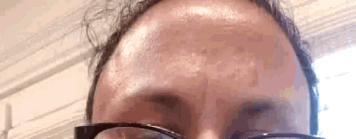 a close up of a woman 's forehead with glasses and sweat on it .