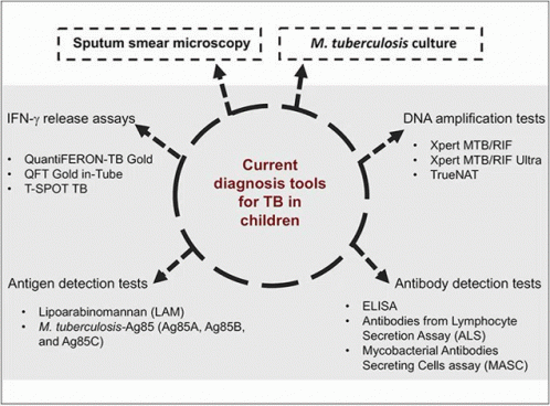 Uk Tuberculosis Diagnosis And Treatmen GIF - Uk Tuberculosis Diagnosis And Treatmen GIFs