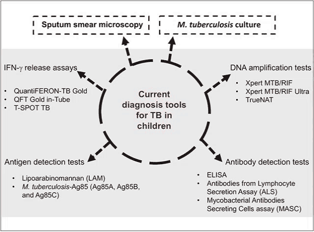 a diagram shows the current diagnostic tools for tb in children