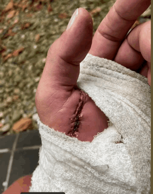 a close up of a person 's hand with a bandage