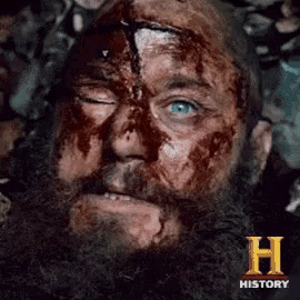 a close up of a man 's face with blood coming out of it and the letter h in the corner