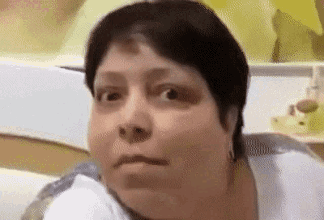 a woman with a black eye is making a funny face .