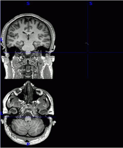 Human Brain Mri Gif Brain Gif GIF - Human Brain Mri Gif Brain Mri Gif Brain Gif GIFs
