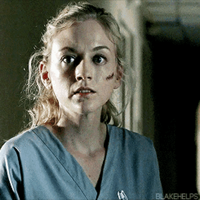 a woman with a scar on her face is wearing a blue scrub top