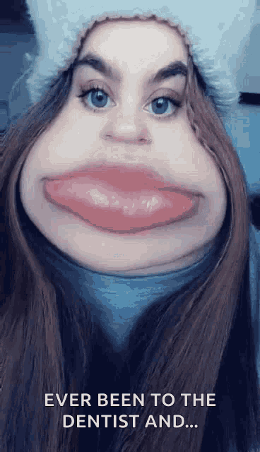 Lilrevengebaby Funny Face GIF - Lilrevengebaby Funny Face Big Mouth GIFs