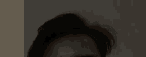 a close up of a man 's forehead with a red spot on it .
