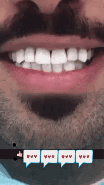 Mustapha Djihad White Teeth GIF - Mustapha Djihad White Teeth Smile GIFs