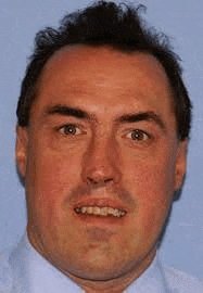 a close up of a man 's face with braces on his teeth and a blue shirt .