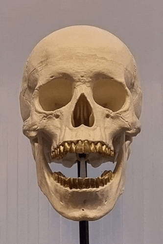 a close up of a skull with a missing tooth