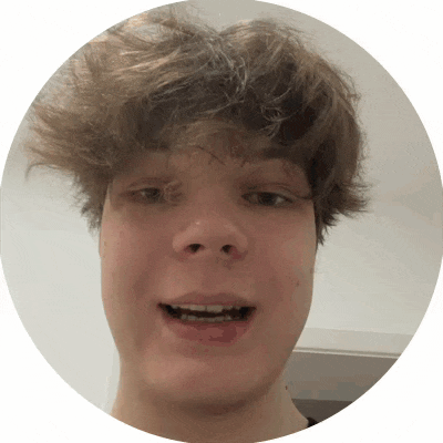 a young man with braces on his teeth is smiling for the camera