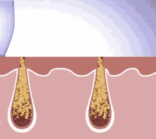 a drawing of the inside of a person 's skin with a glass of water being poured into it