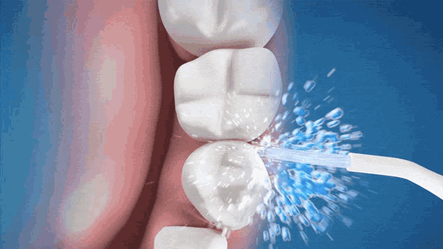 a close up of a person 's teeth being cleaned with a water floss