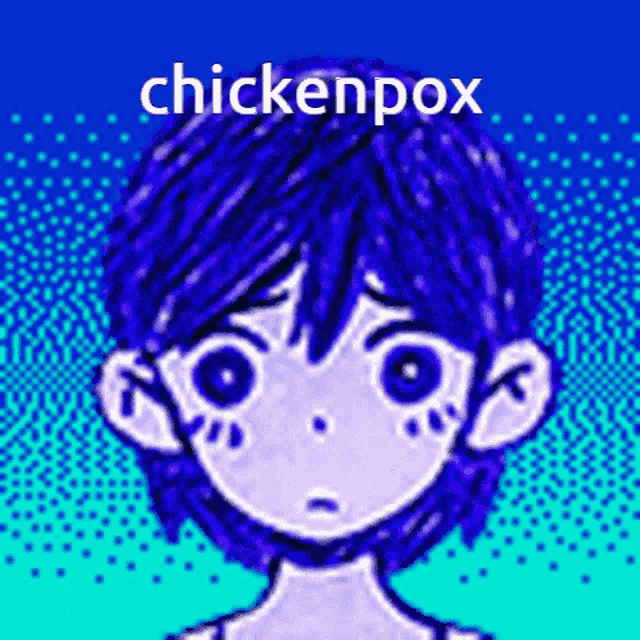 a cartoon of a boy with blue hair and the words chickenpox above him