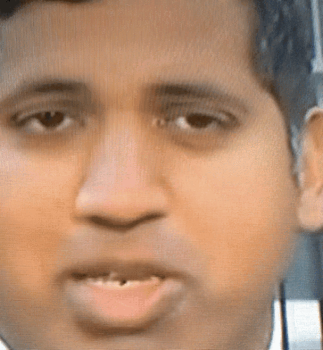 a close up of a man 's face with his mouth open and his teeth missing