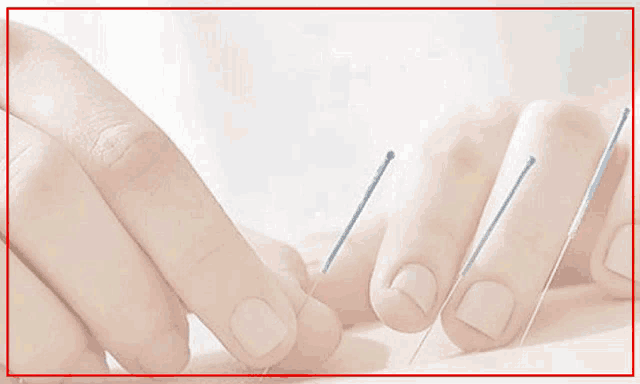 an advertisement for acupuncture treatment in toronto with a phone number